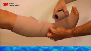 Download the video "UK 3M™ Coban™ 2 Layer Compression System Application Guide below knee"