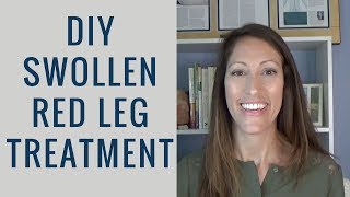 How to Reduce Swollen and Red Legs, Feet and Ankles | Lymphedema from Chronic Venous Insufficiency