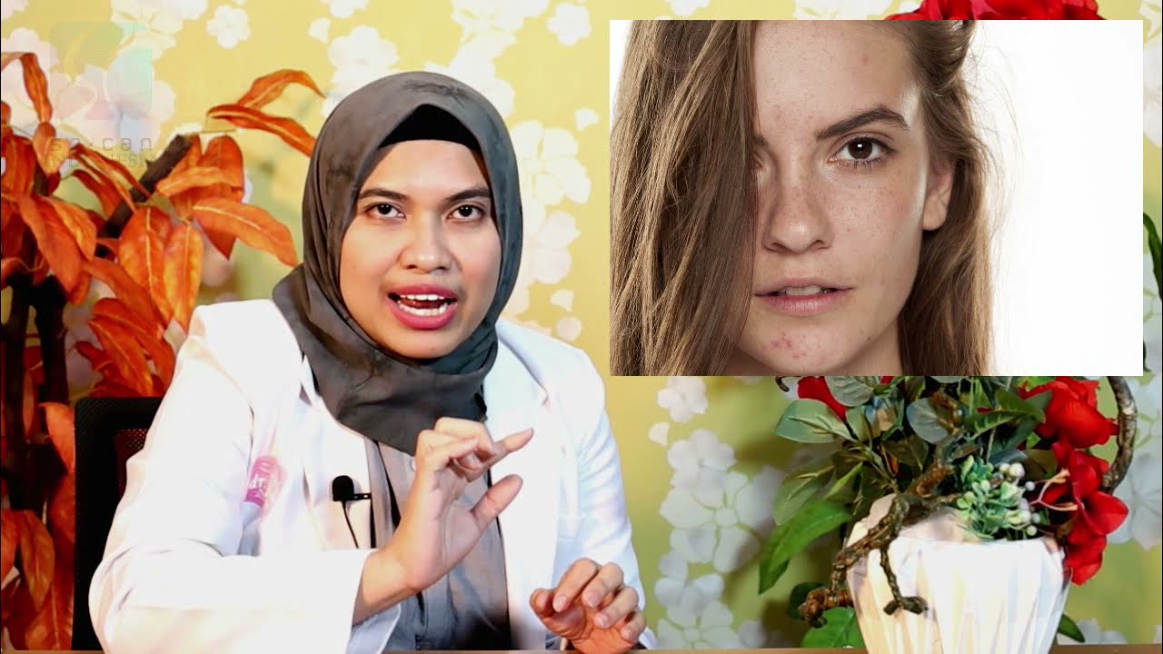 Punya Masalah Pigmentasi Kulit Ini Cara Mengatasinya