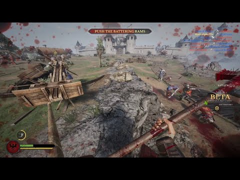 Chivalry 2 - Ballista Power....