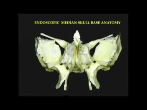 Endoscopic approach to Lateral Skull base