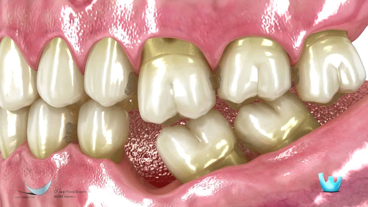 Jacqueline Molina Torres-9