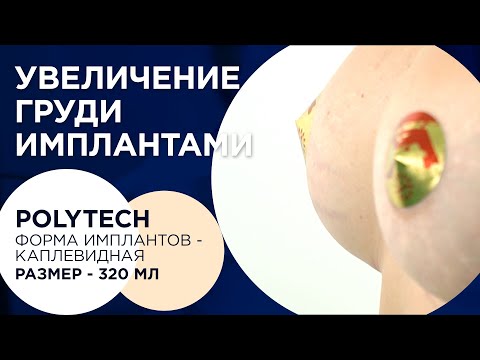 Valentin Zykov-79