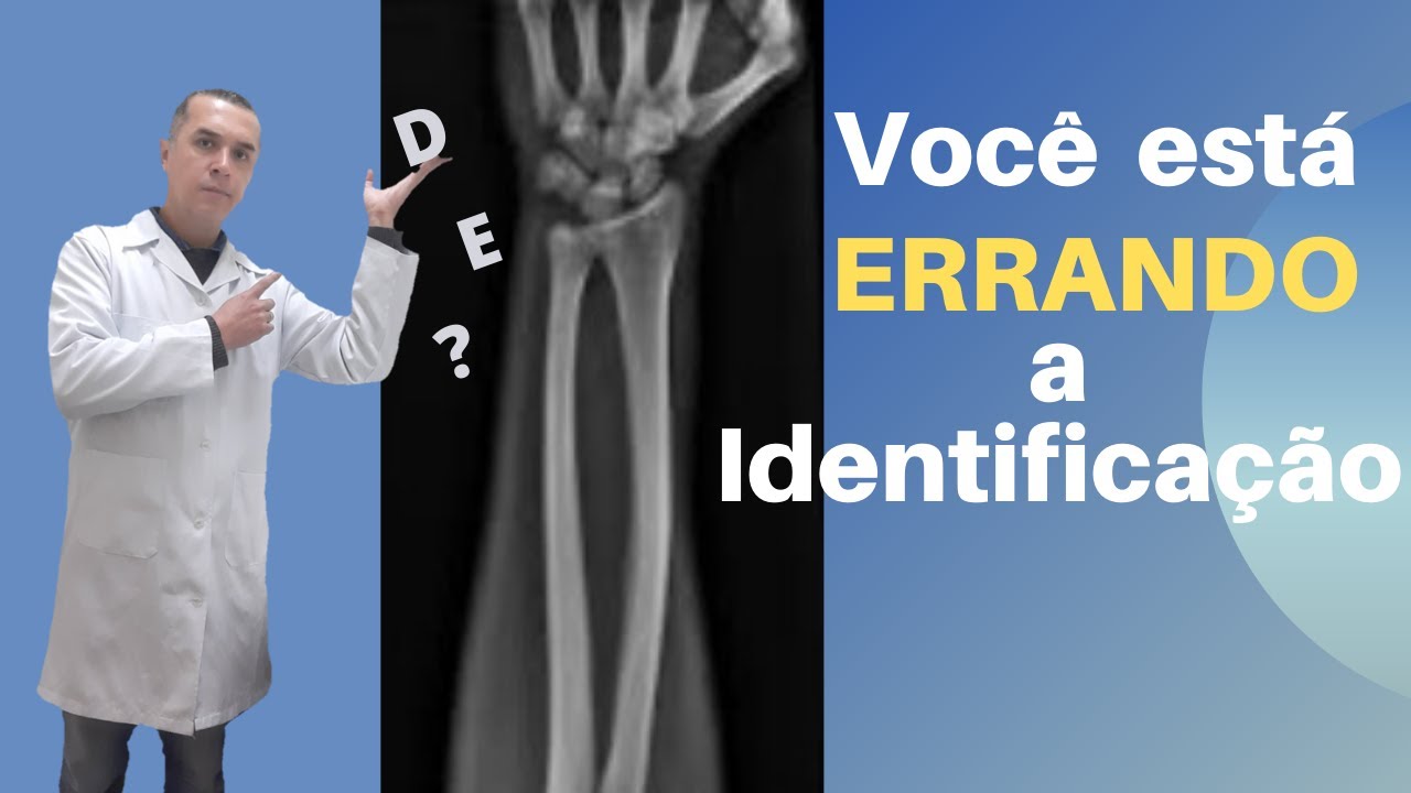 Como Identificar as Radiografias Corretamente?  Aprenda de Maneira Fácil