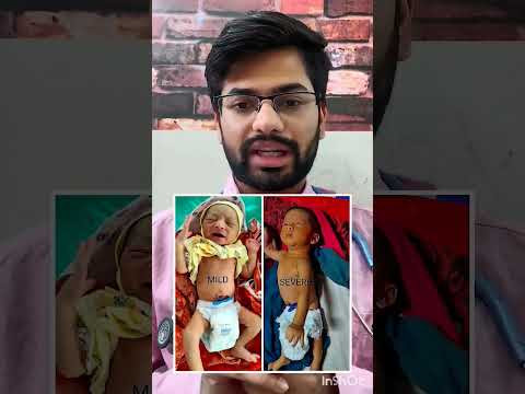 मेरा बच्चा पीला क्यों दिख रहा है ? क्या उसे पीलिया/jaundice है ? Jaundice/पीलिया #babyhealth