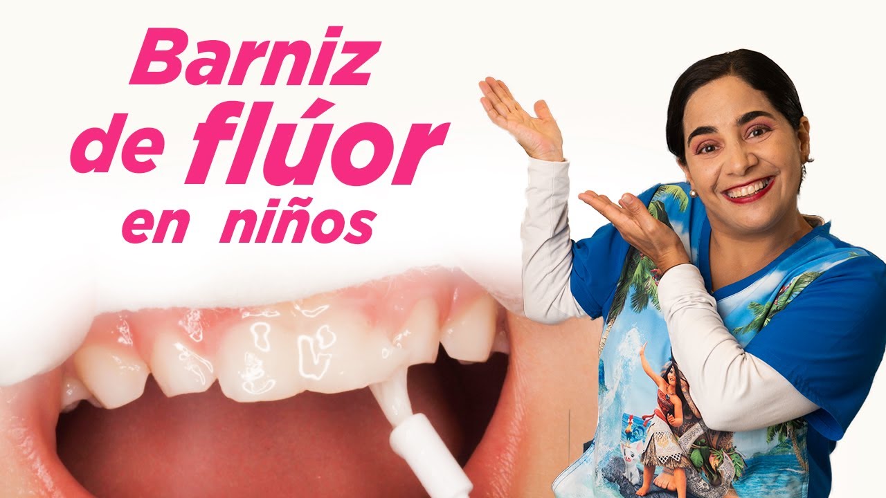 Barniz de flúor: ¿Qué es y para que sirve