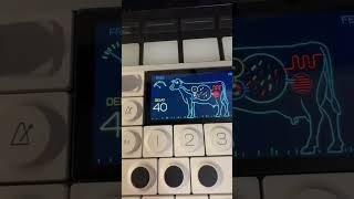 Download lagu Op-1 is TOTALLY worth $2000 #sounddesign #op1 #teenageengineering #musicproduction mp3 Download lagu Op-1 is TOTALLY worth $2000 #sounddesign #op1 #teenageengineering #musicproduction mp3