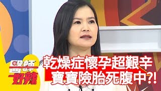 乾燥症懷孕超艱辛！寶寶臍帶乾掉，險胎死腹中？！【醫師好辣】20191008 part3 EP823 陳榮堅 黃捷