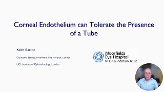 Tubes and the Corneal Endothelium