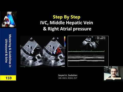 Step by Step: IVC, Hepatic vein & Right atrial pressure
