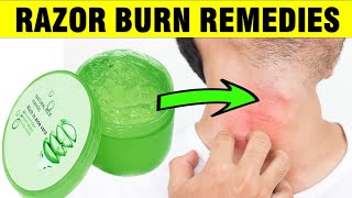 HOW TO GET RID OF RAZOR BUMPS WITH HOME REMEDIES