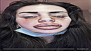 ALAGIO TAK CO TI JE?!