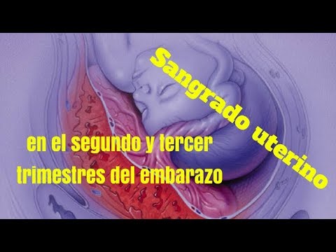 Si es posible sentarse en la dieta de trigo sarraceno con la diabetes Insulina para la diabetes aumenta