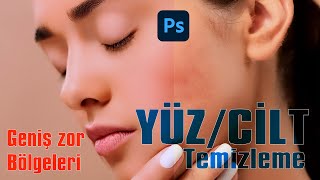 YÜZ/CİLT TEMİZLEME | Photoshop Dersleri