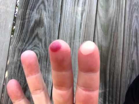 The Daily Woo - Day 76 - 9/15/2012 - I Got Blisters On My Fingers