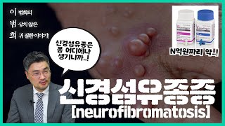 커피반점이 보이면 의심하라! 신경섬유종증 [월간 이.범.희] Ep.1