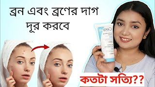 ত্বক উজ্জ্বল করার ক্রিম | ব্রণের দাগ দূর করবে যে ময়েশ্চরায়জার - CeraVe Moisturizing Cream Review