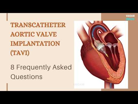 TAVI - 8 Frequently Asked Questions