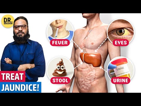 Jaundice (Yarkan) Ka Ilaj | How to Manage Jaundice Naturally | Dr. Ibrahim