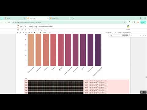 Bone X-Ray Jupiter in Python Projects