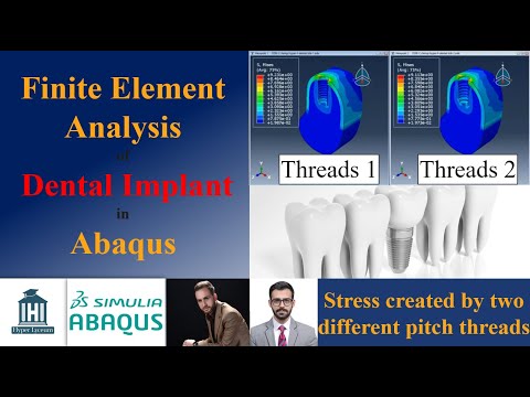 Finite Element Analysis of Dental Implant in Abaqus
