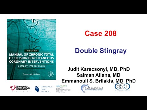 Case 208: Manual of CTO PCI - Double Stingray