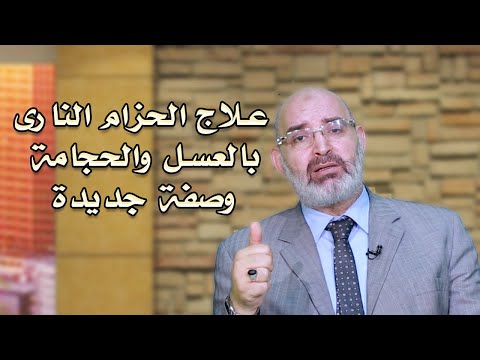 علاج الحزام النارى وصفات من الطبيعة دكتور أمير صالح