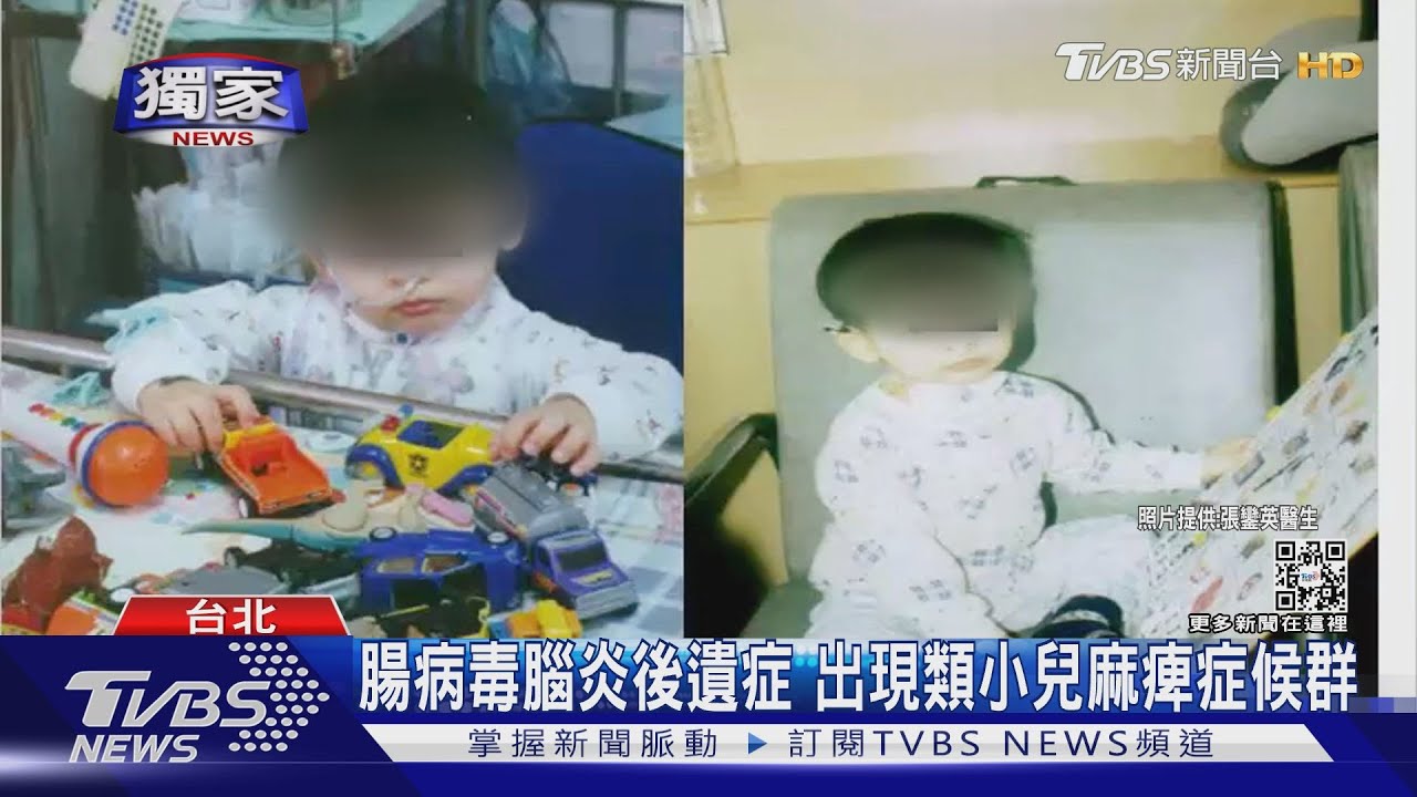 獨家！腸病毒腦炎兒童後遺症「類小兒麻痺症候群」　新冠會嗎？