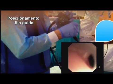 Ernia del trattamento con farmaci colonna lombare Unguento per giunti germanio