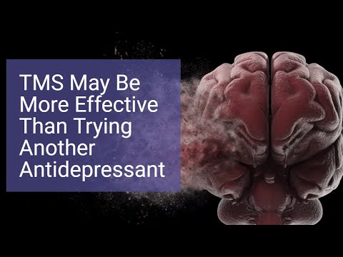 Tried Multiple Antidepressants? Consider Switching to TMS - STAR*D vs. Carpenter Study Results