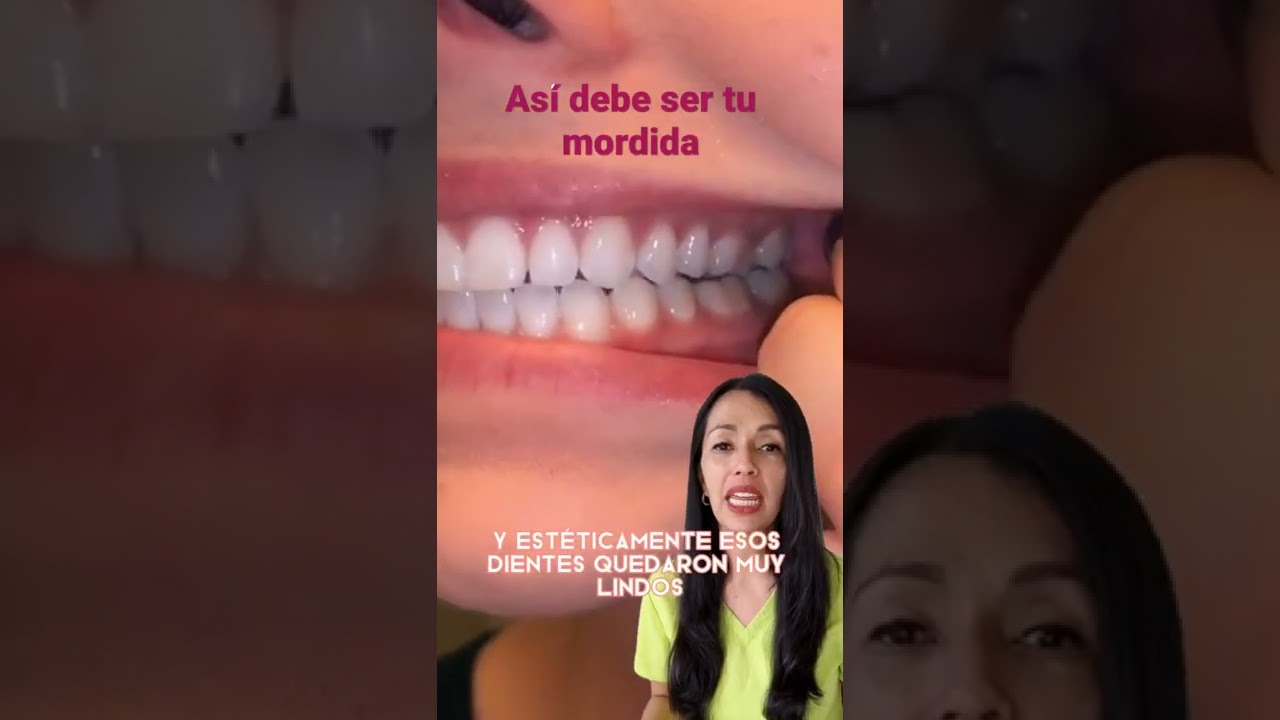 MODIDA CORRECTA 😃. así debes morder