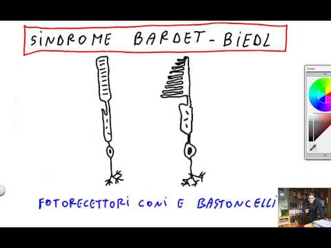 CORSO DI GENETICA UMANA - LEZIONE 11 - BASI MOLECOLARI DELLE MALATTIE GENETICHE