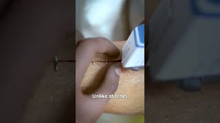 How Medical Staples Work 🤔