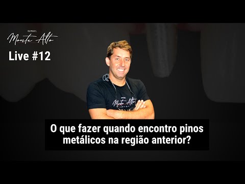 , title : 'Live 12 - O que fazer quando encontro pinos metálicos na região anterior?'