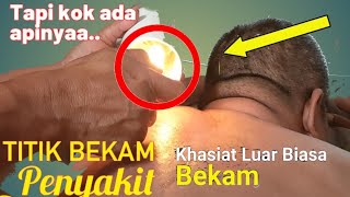 Download lagu Bekam Api & Pijat | Terapi Nyeri Punggung Langsung Sembuh! mp3 Download lagu Bekam Api & Pijat | Terapi Nyeri Punggung Langsung Sembuh! mp3