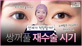 가장 적합한 재수술 시기는 따로 있다? ㅣ 탑티어성형외과