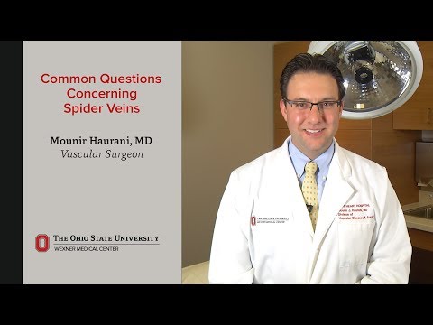 FAQ about spider veins | Ohio State Medical Center