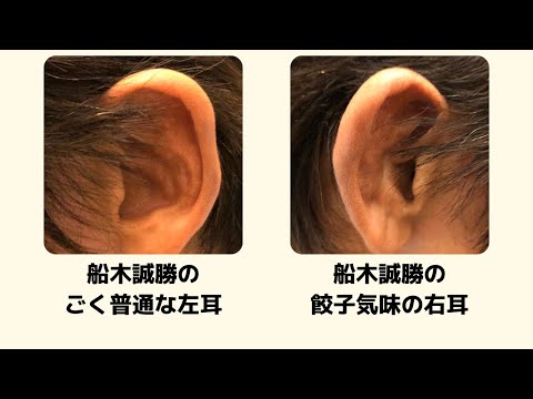 柔道・レスリング経験者の餃子耳（耳介血腫）を船木誠勝はどう思っていたのか？