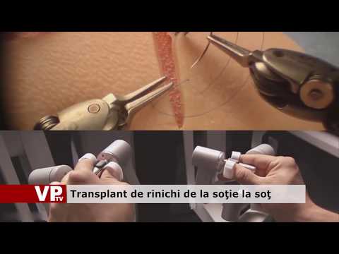 Transplant de rinichi de la soție la soț