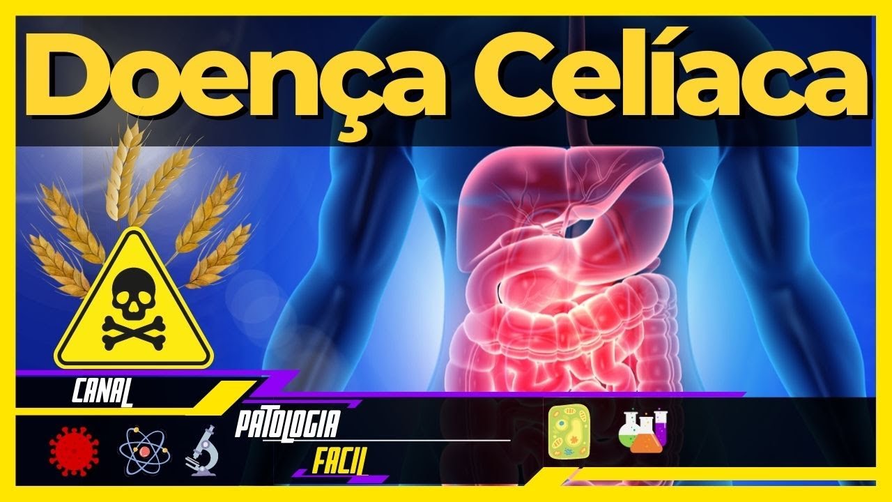 O que é Doença Celíaca? [Sintomas, Fisiopatologia, Tratamento e Diagnóstico]