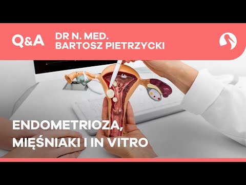 Mięśniaki przy endometriozie a in vitro
