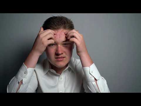 Was kann ich gegen eine Wasserallergie tun?