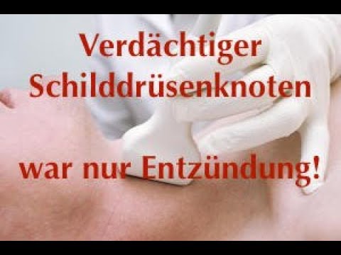 Die Auswirkungen der Prostatitis auf Frau Was Tabletten Männer von Prostatitis trinken sollten
