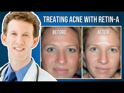 How Does Retin-A (Tretinoin) Improve the Skin?