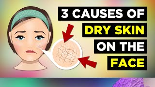 3 Causes Of Dry Skin On The Face (Dry Skin Remedies)