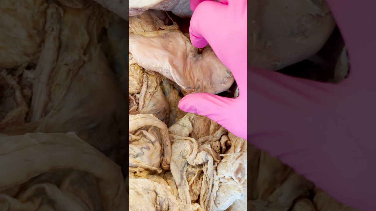 Understanding the Pancreas: Its Role in Hormones and Digestion | Galaxy.ai