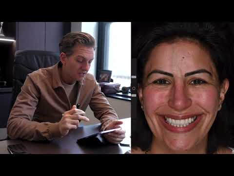 She went to another doctor and came back - VENEERS REDO