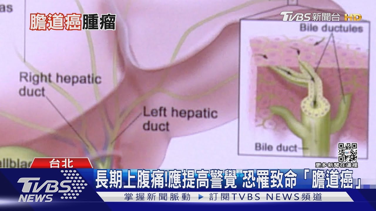 不常被討論沉默殺手「膽道癌」國衛院研發這藥物 延長存活期!