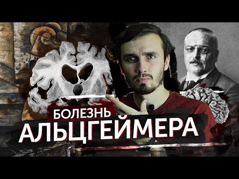 , title : 'Болезнь Альцгеймера - [История Медицины]'