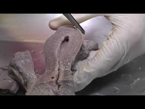 Sistema Genital Feminino- Minuto Anatômico